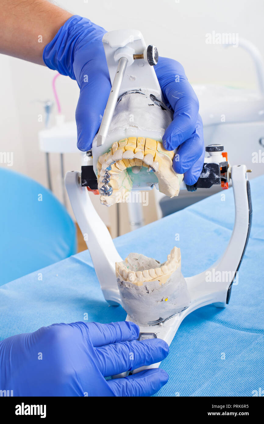 Dentist using dental articulator for a correct occlusion Stock Photo