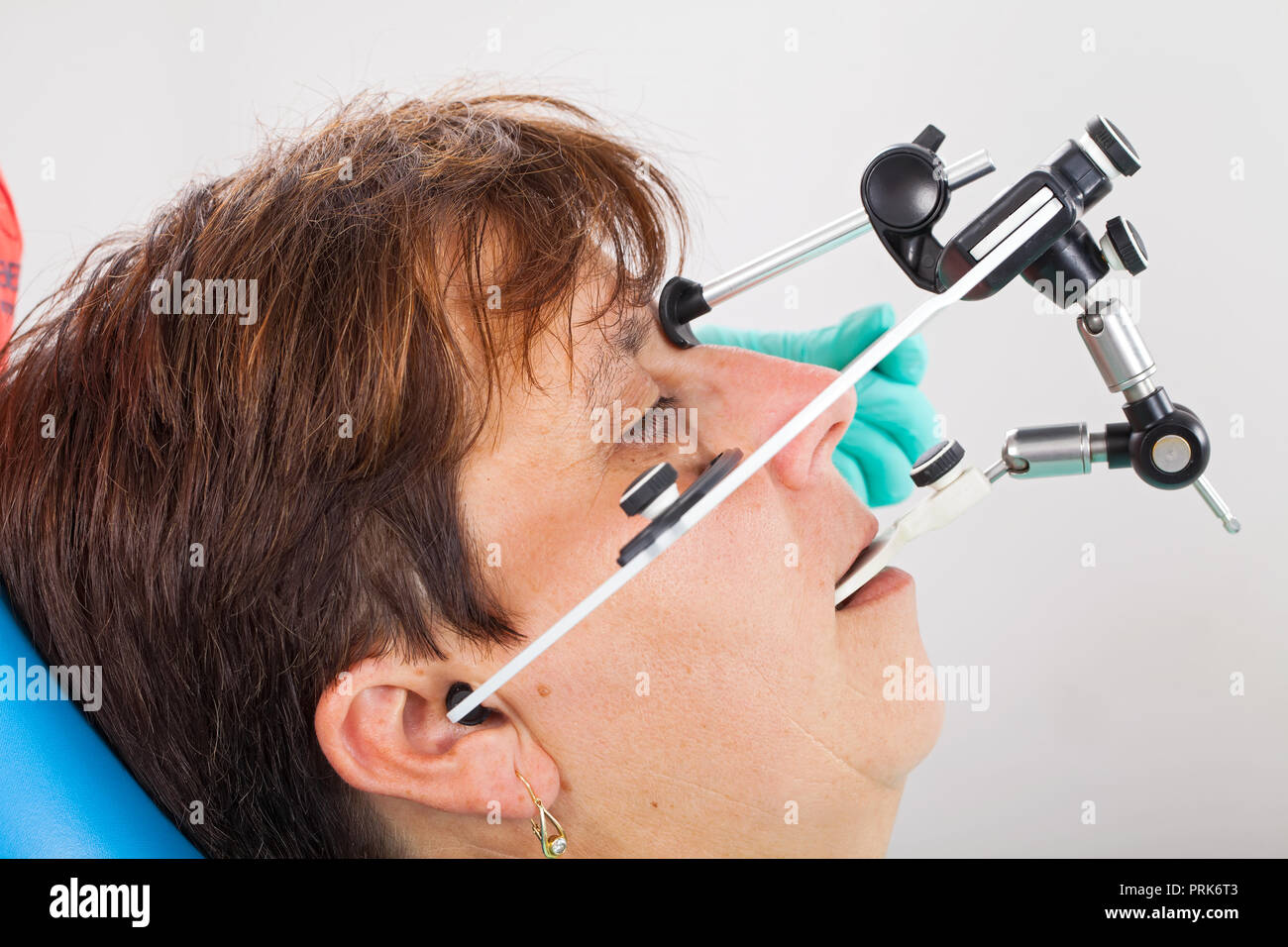 Seniorpatient wearing a facebow for transfer functional and aesthetic