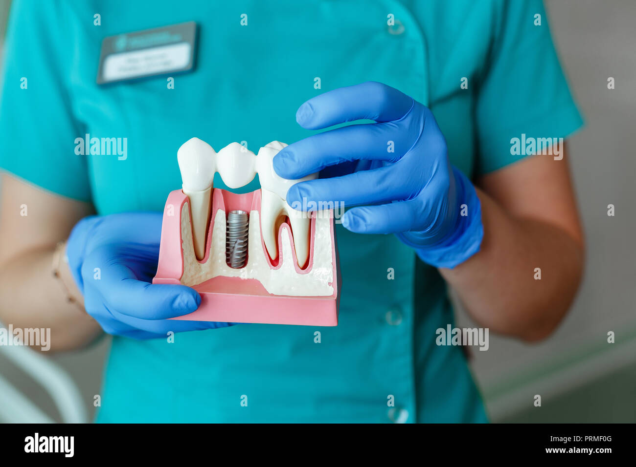 hands of the dentist hold a breadboard model of the tooth with an ...