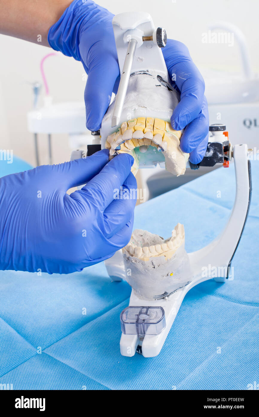 Dentist using dental articulator for a correct occlusion Stock Photo
