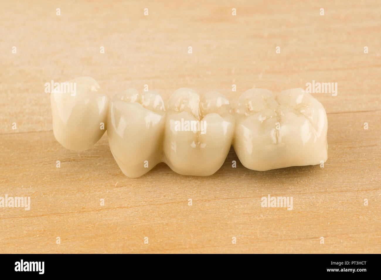artificial dental structures made of ceramics for restoration of