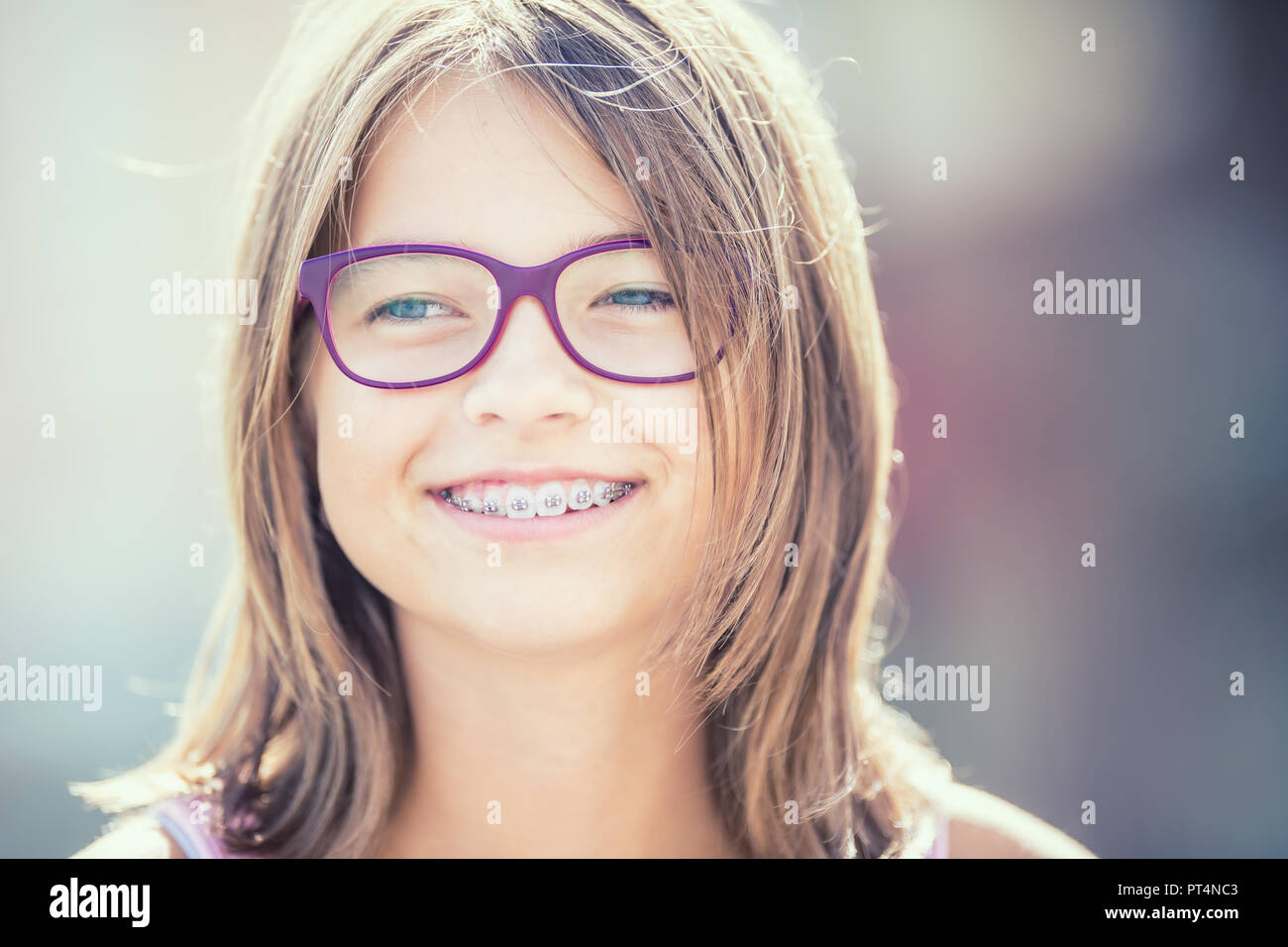 Glasses dental braces hires stock photography and images Alamy
