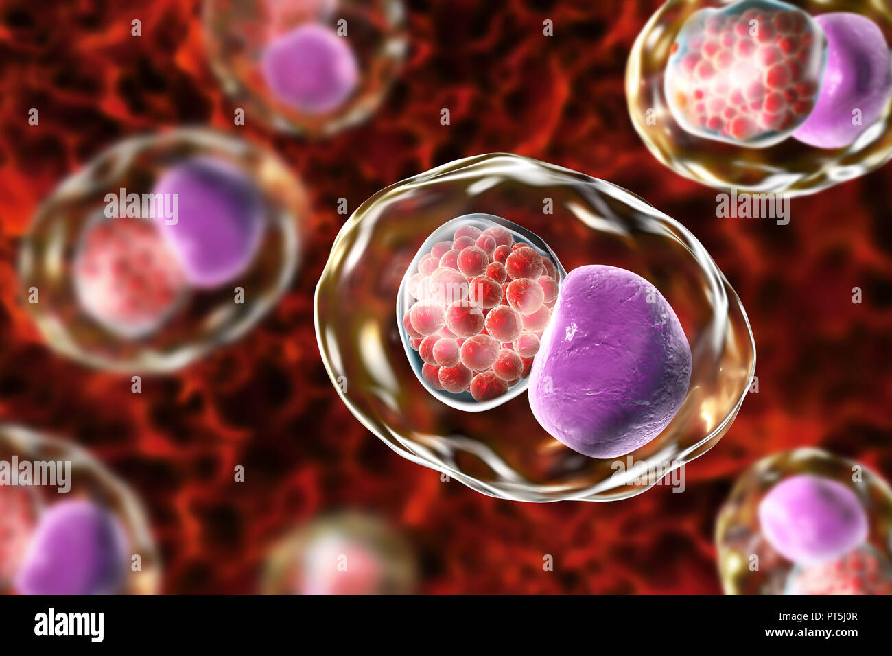 Chlamydia trachomatis bacteria. Computer illustration showing an inclusion composed of a group of chlamydia reticulate bodies (intracellular multiplying stage, small red spheres) near the nucleus (purple) of a cell. Chlamydia trachomatis causes a sexually transmitted infection that can go undetected causing infertility. It also causes the eye disease trachoma, which can lead to blindness. Stock Photo