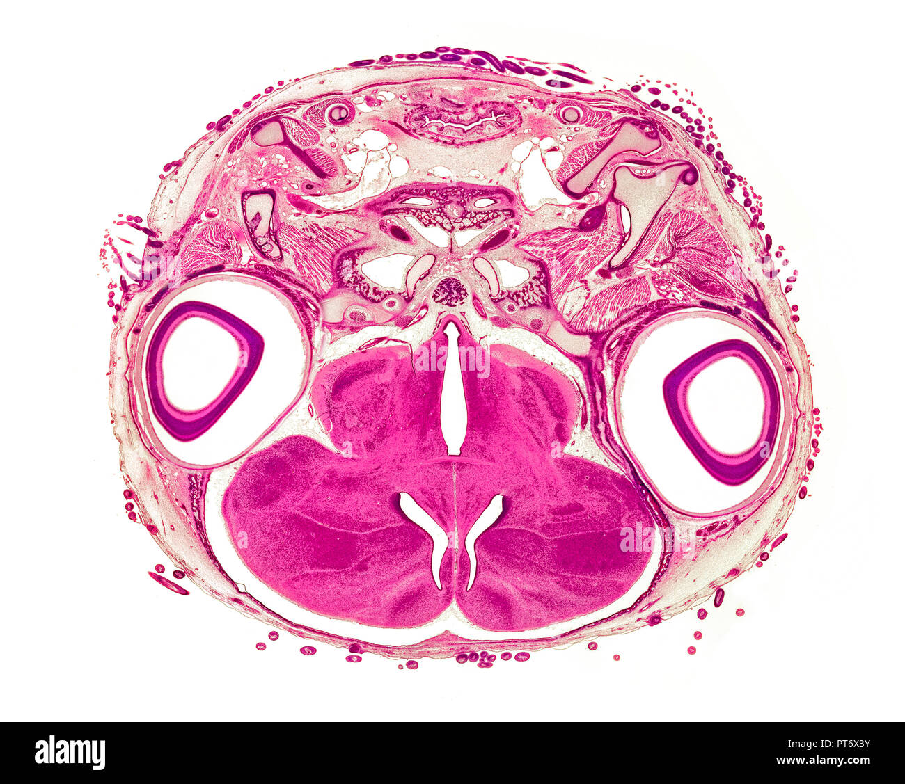 Chick embryo 17 days XS head section, brightfield photomicrograph Stock Photo