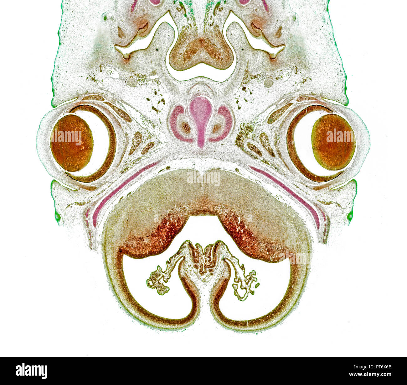Pig embryo head-eye region,  brightfield photomicrograph Stock Photo