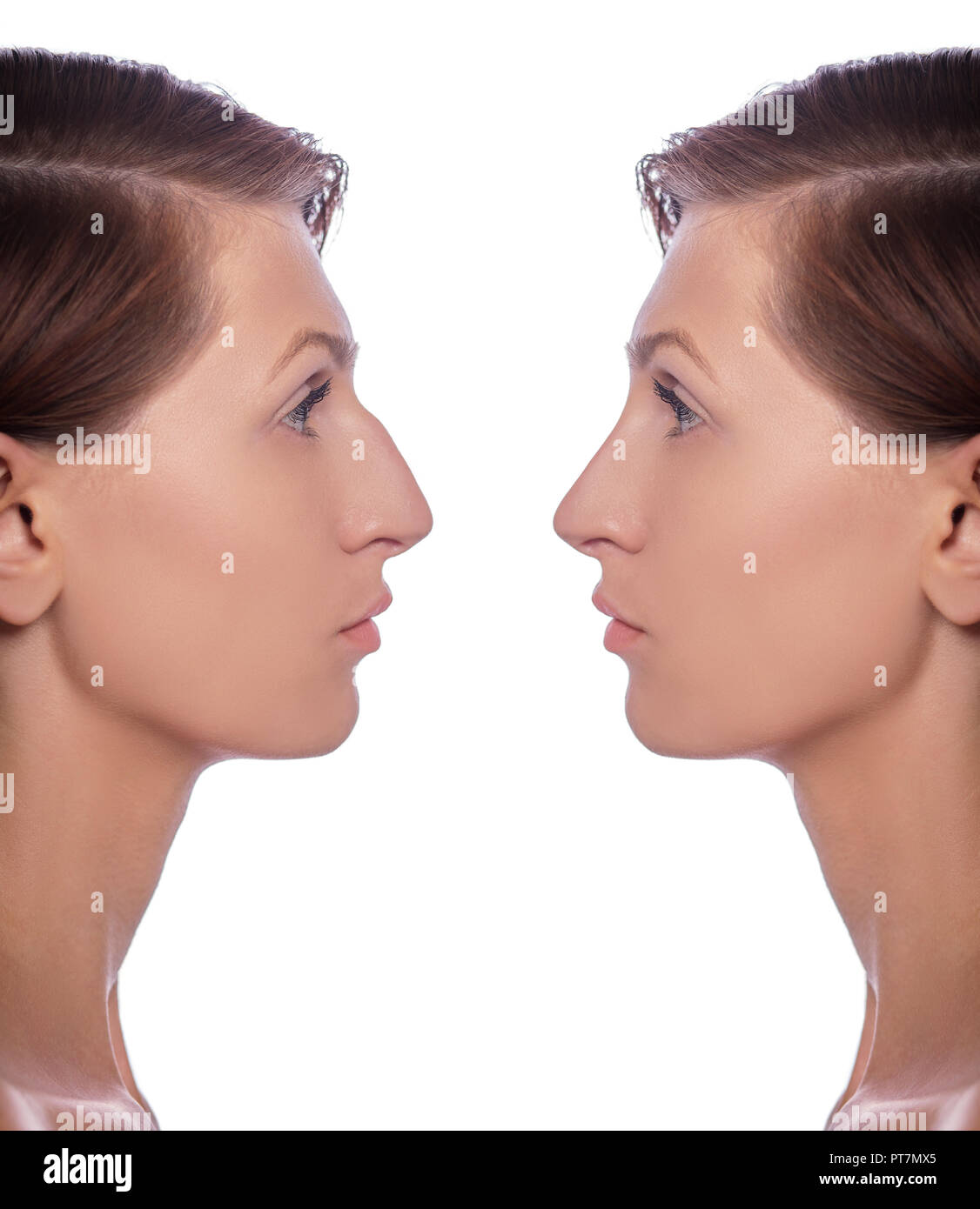 profile female before and after plastic surgery on her nose Stock Photo