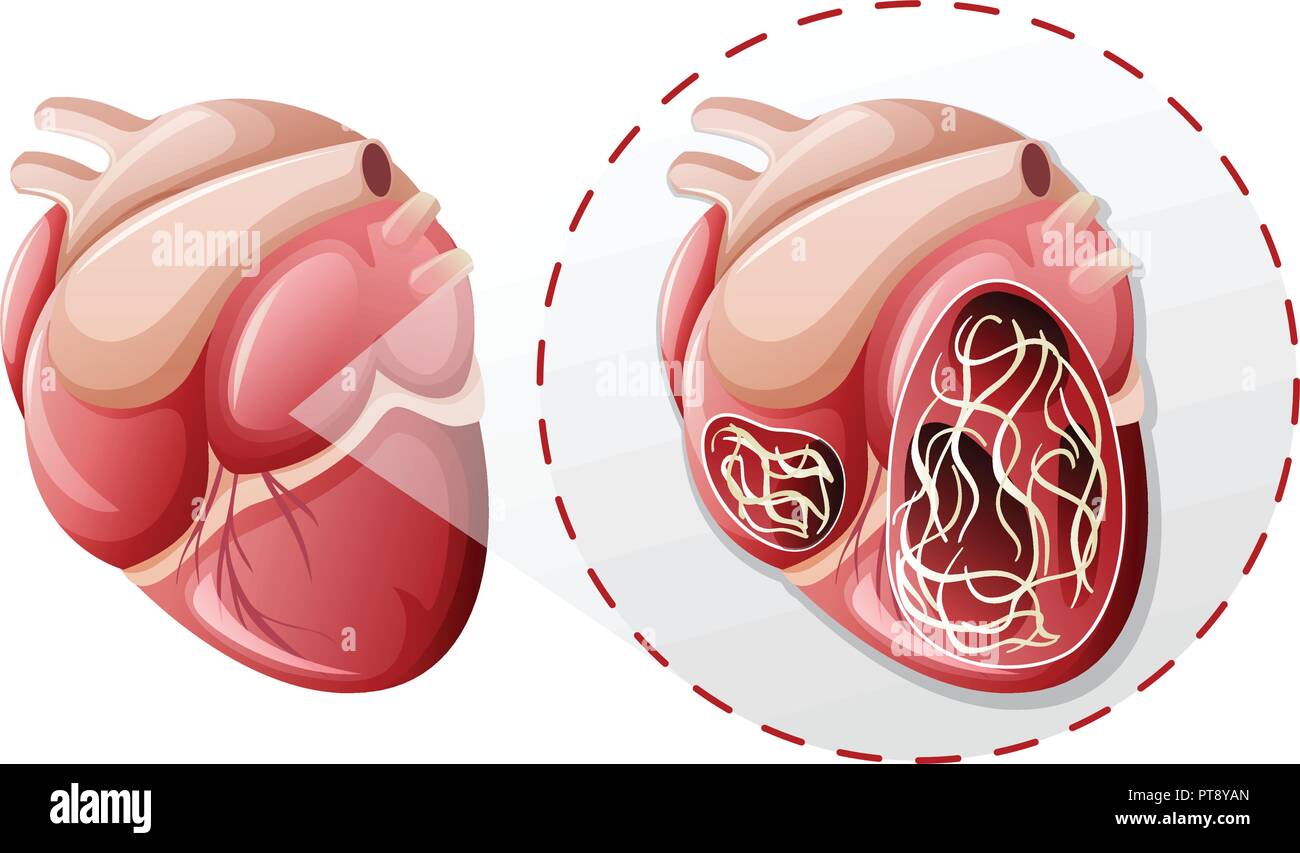 magnified heart worm concept illustration Stock Vector Image & Art Alamy