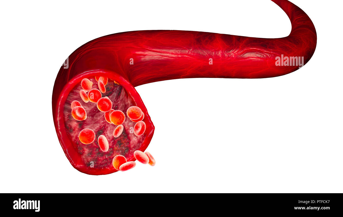 Red blood cells and blood flow through a vein, small spherical cells that contain hemoglobin, a protein that gives a red color to the blood Stock Photo