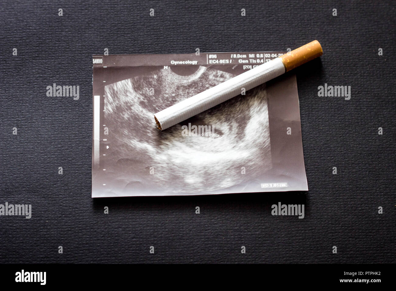 Cigarette on the picture of uzi pregnancy, pregnancy and smoking, smoke, gestation Stock Photo