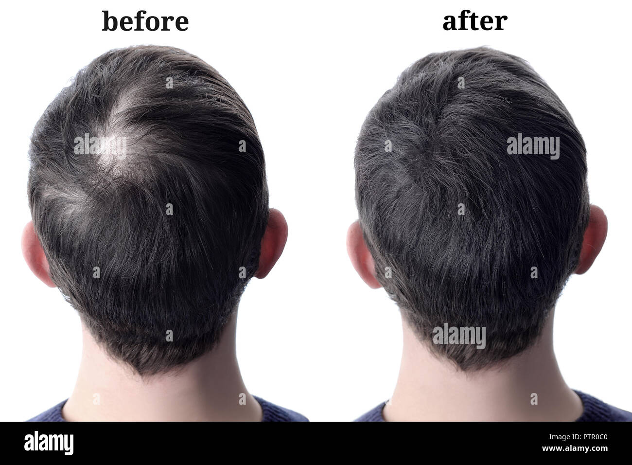 menshair-hi-res-stock-photography-and-images-alamy