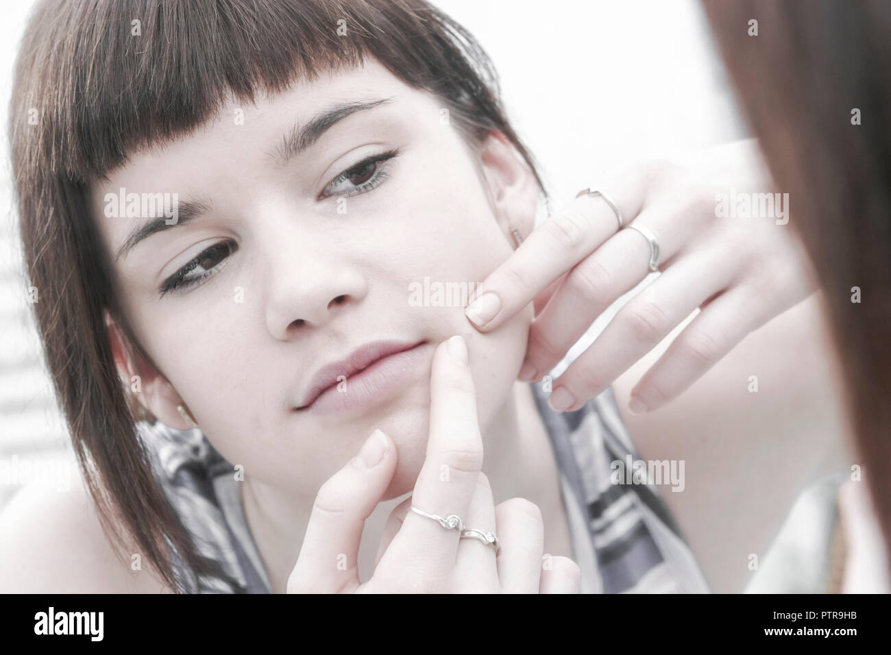 Akne Teenager High Resolution Stock Photography And Images Alamy