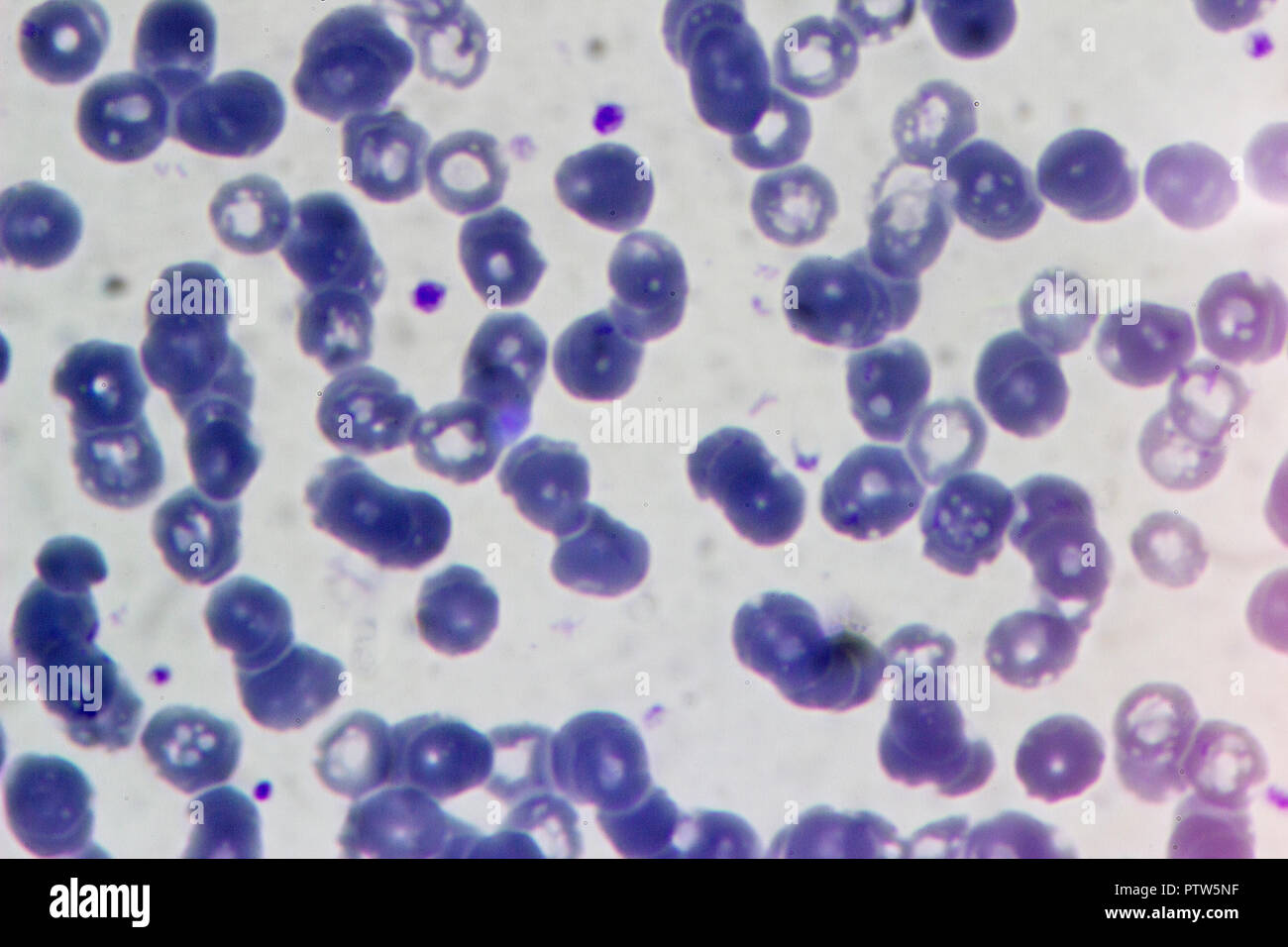 Blood analysis under a microscope, close-up Stock Photo - Alamy