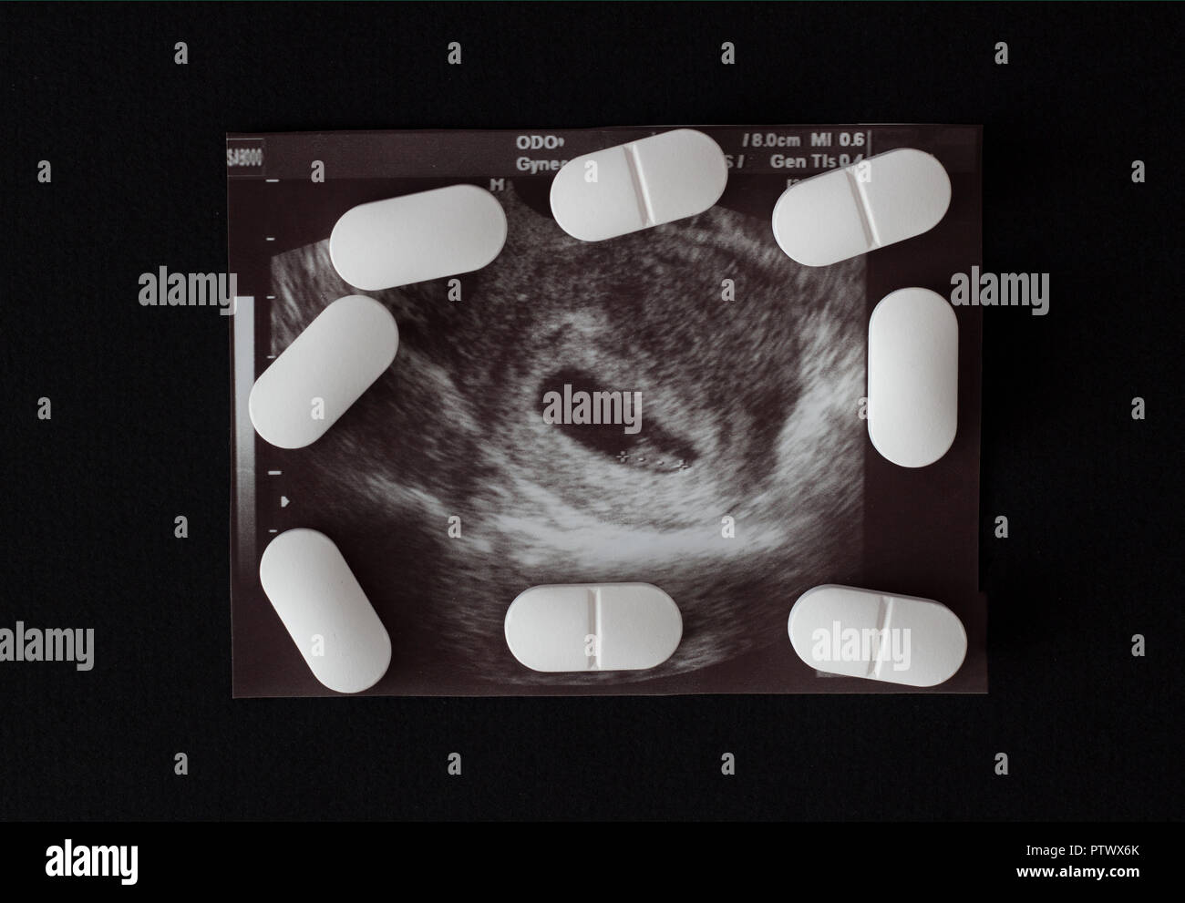Abortion Pill High Resolution Stock Photography and Images - Alamy
