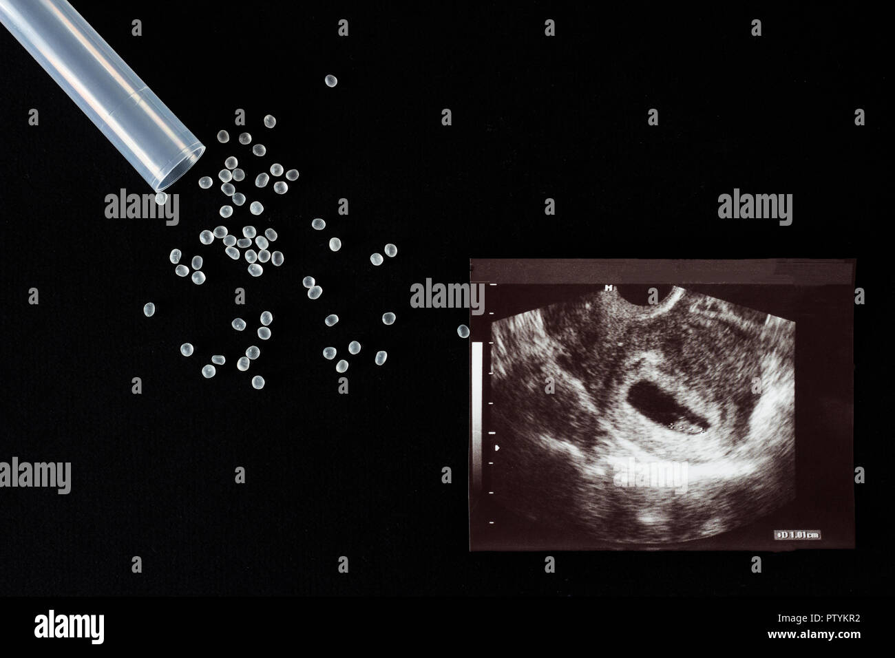 Uzi shot, pills and test tube on a black background, abortion, close-up Stock Photo