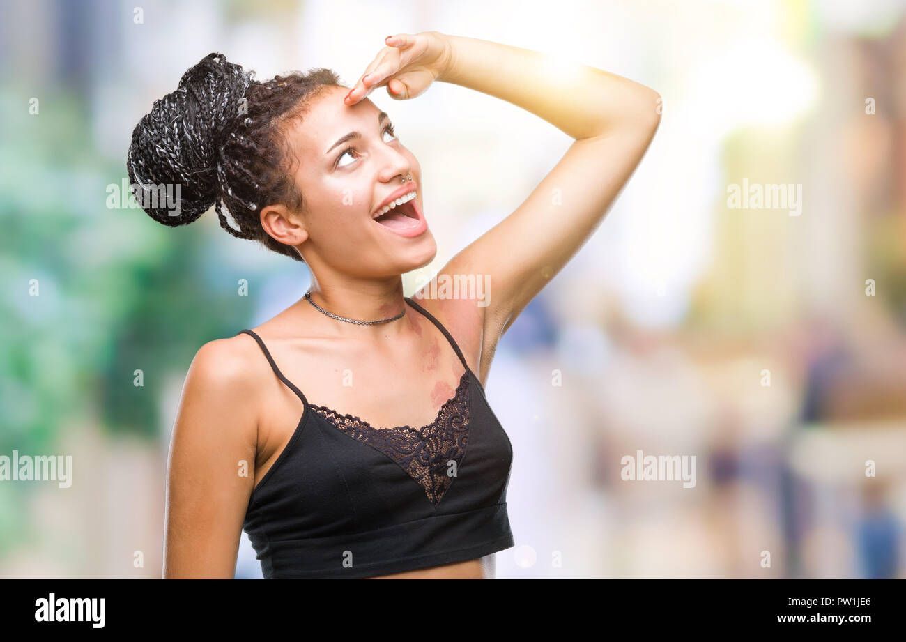 Young Braided Hair African American With Pigmentation Blemish