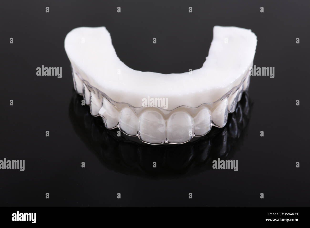 Tooth Crown Pattern Wax pattern teeth dental crowns on model, metal free - front view ...