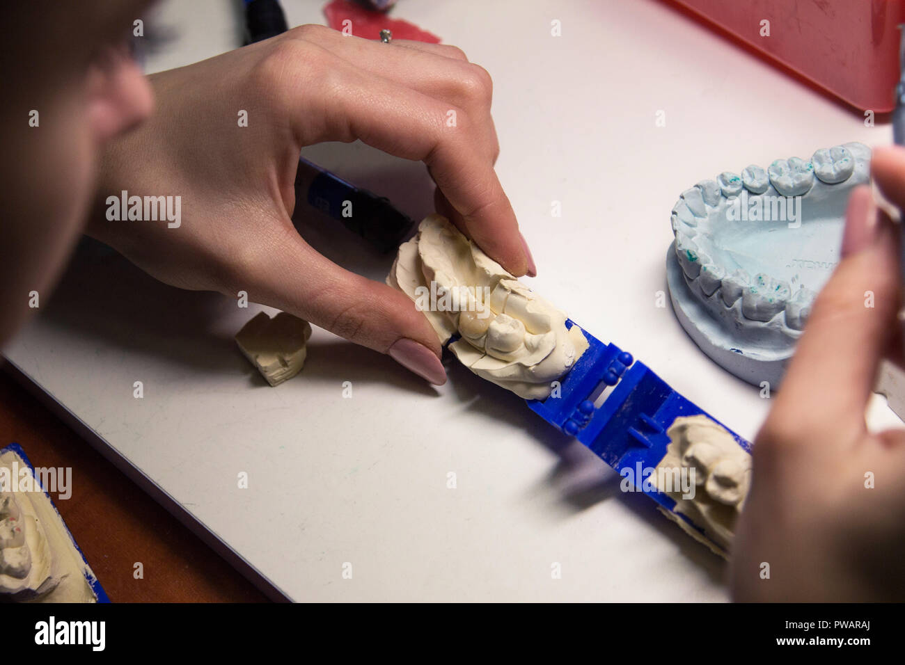 Dental prosthesis, artificial tooth, prosthetic, hands working on the