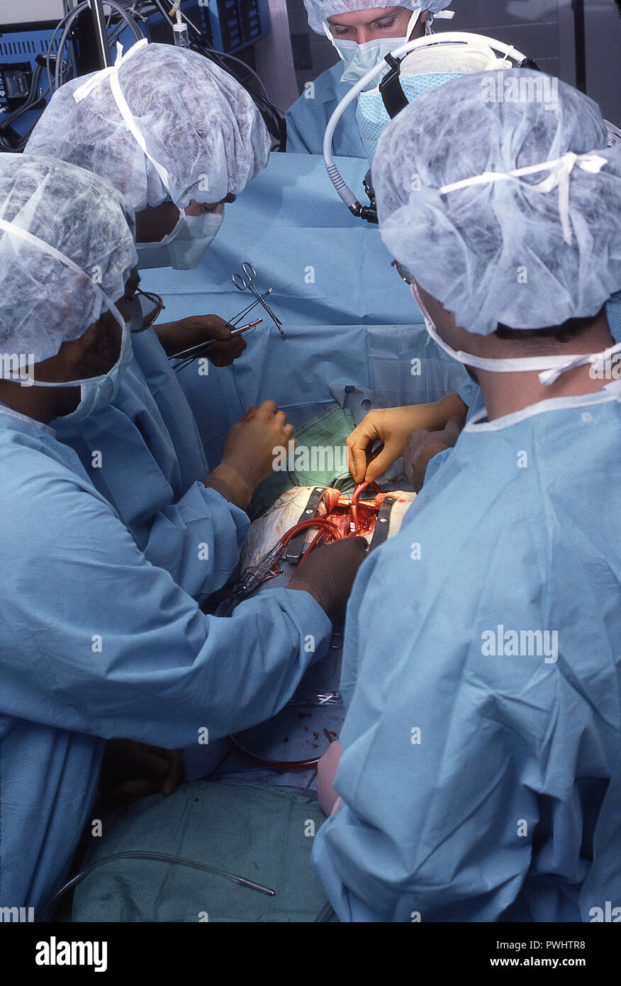 Open Heart Surgery Stock Photo
