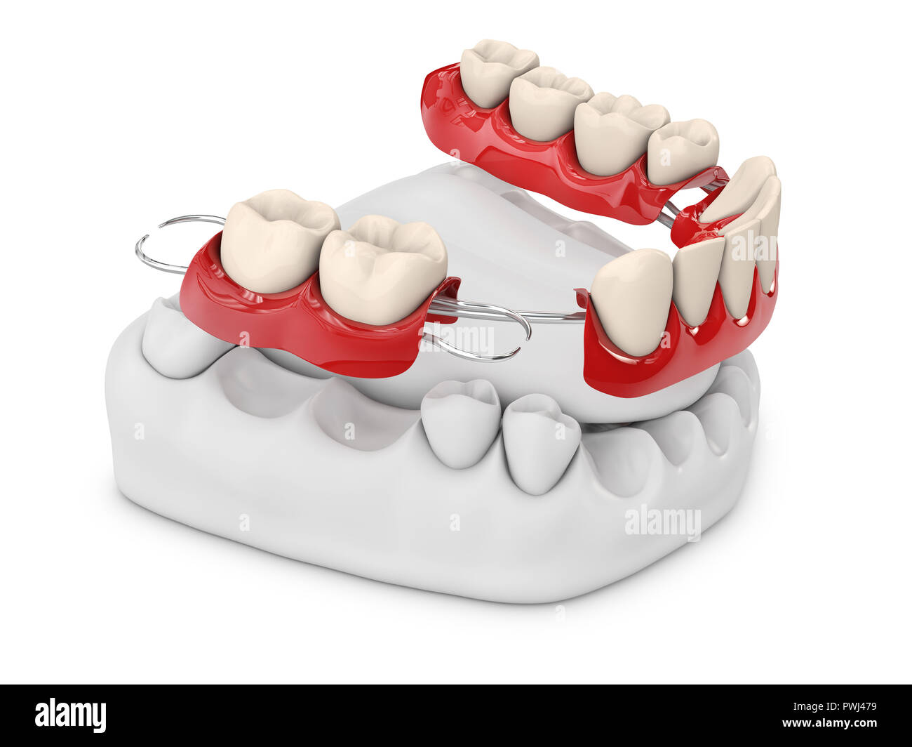 Human teeth with denture. 3d illustration isolated white Stock Photo ...