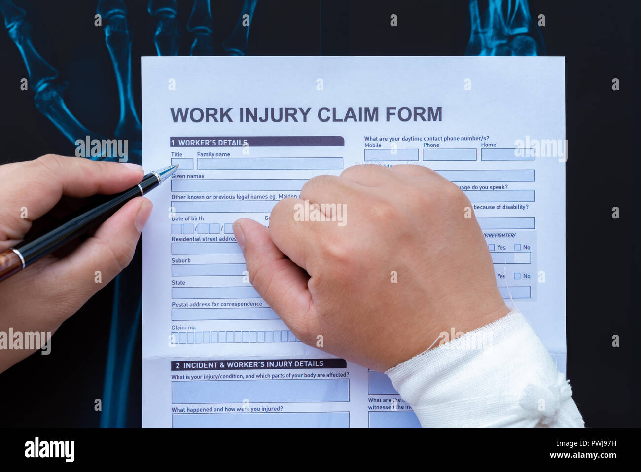 wrapped injury filling a claim on with ... work hand up form a