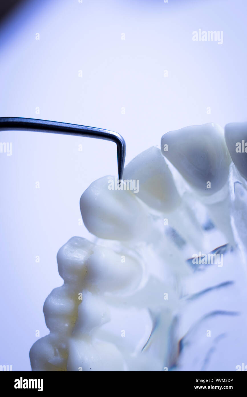 Dentist cleaning teeth with titanium metal tooth pick instrument to