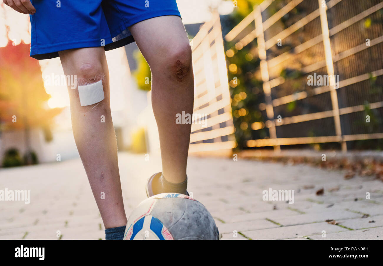 Abrasion knee hires stock photography and images Alamy