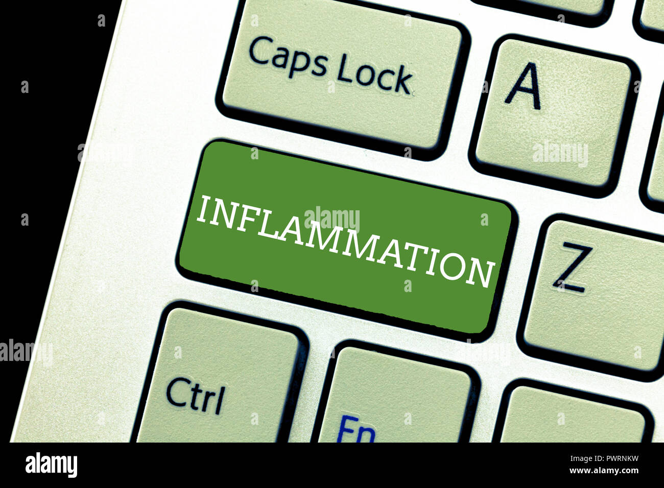 Handwriting text writing Inflammation. Concept meaning Swelling of a