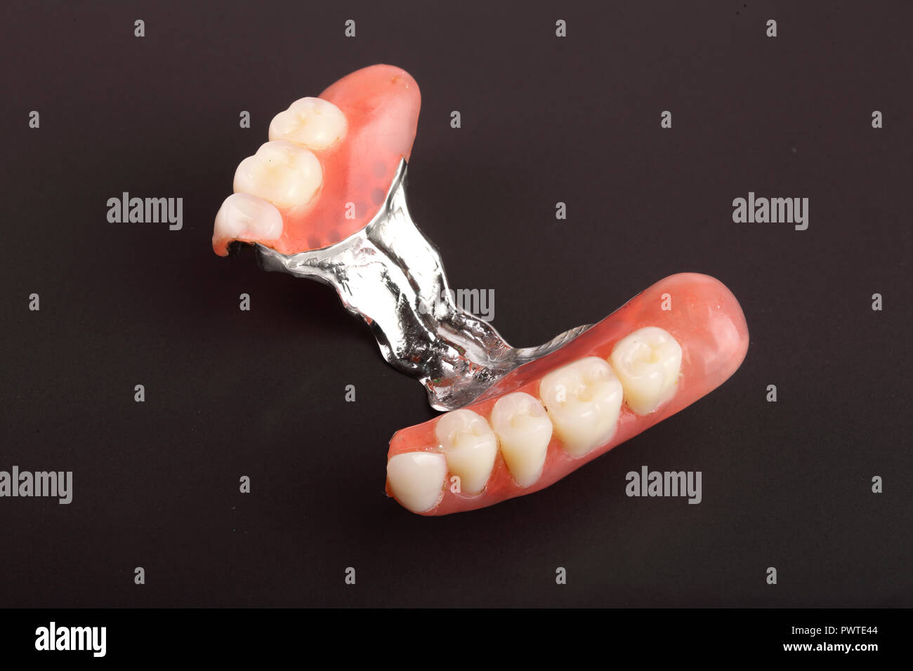Clasp prosthesis with lock fixation isolated on white background macro. Stock Photo