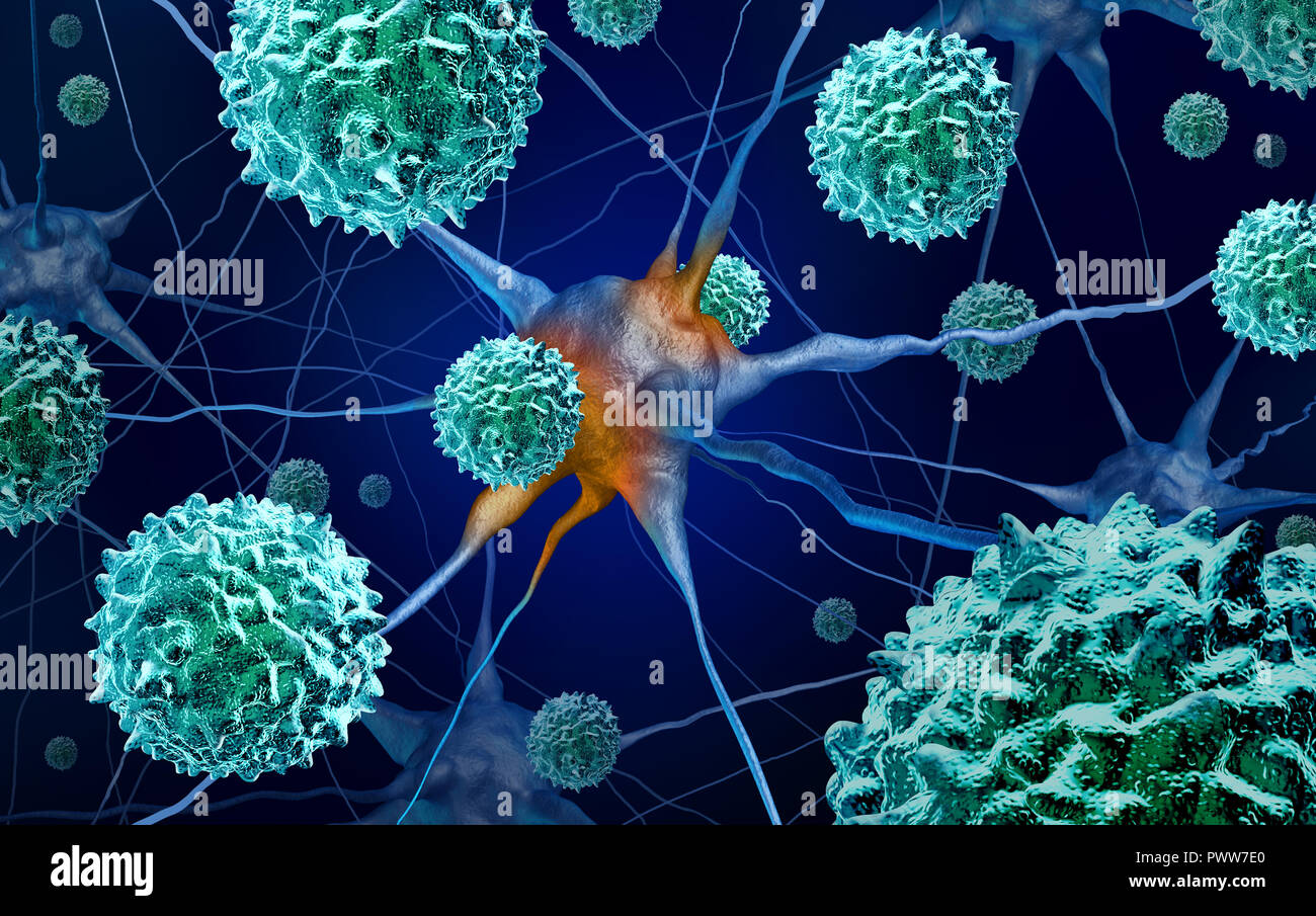 AFM disease or acute flaccid myelitis medical concept as a neurologic condition representing enterovirus or polio virus as a 3D illustration. Stock Photo