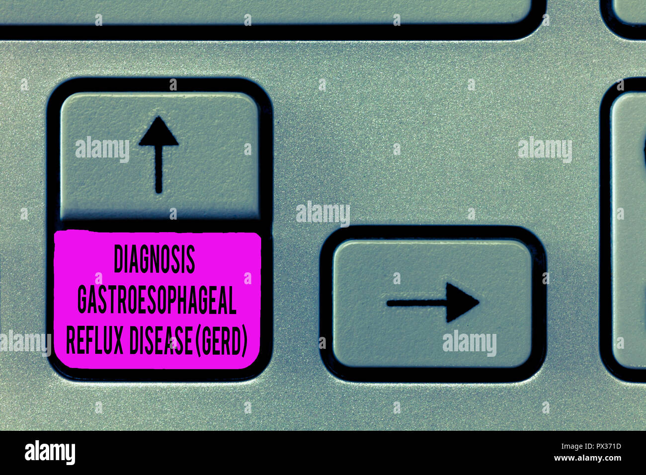 What foods help acid reflux go away image