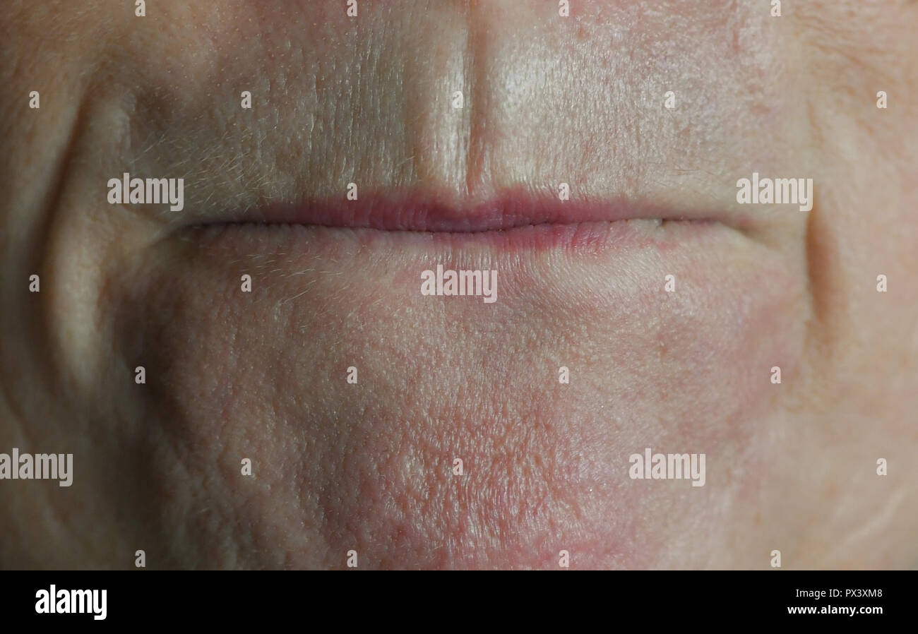 Stottern hi-res stock photography and images - Alamy