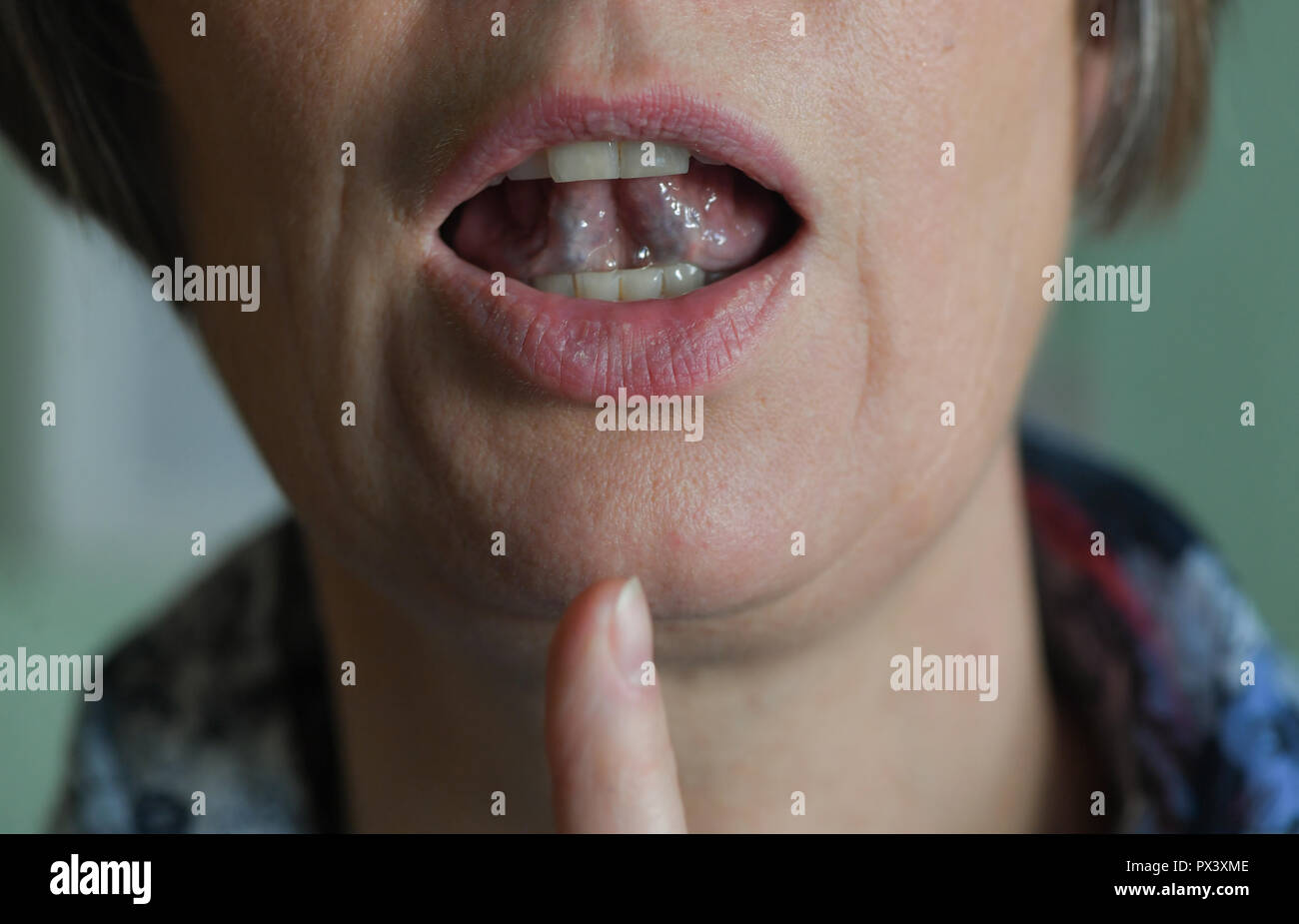 Mouth speech illustration hi-res stock photography and images - Alamy