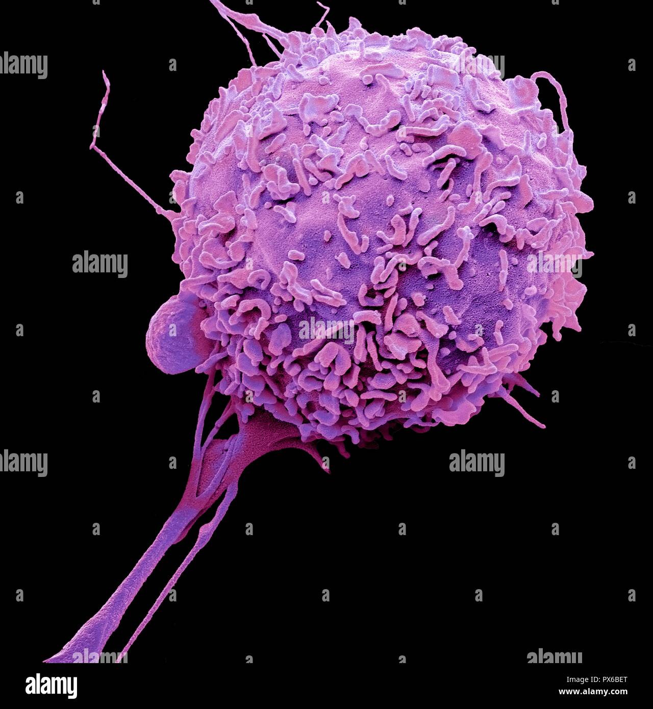 Macrophage. Coloured scanning electron micrograph (SEM) of a macrophage white blood cell. Macrophages are cells of the body's immune system. They are found in the tissues rather than in the circulating blood. Macrophages recognise foreign particles, including bacteria, pollen and dust, and phagocytose (engulf) and digest them. Magnification: x4000 when printed at 10 centimetres wide. Stock Photo