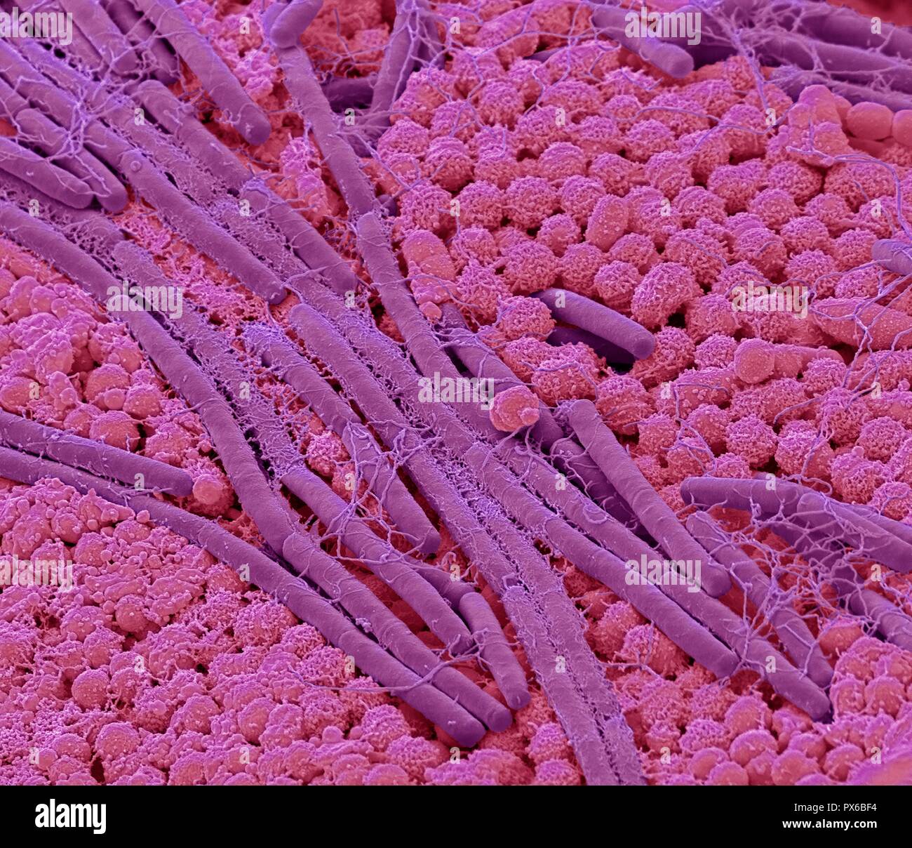 Tongue bacteria. Coloured scanning electron micrograph (SEM) of