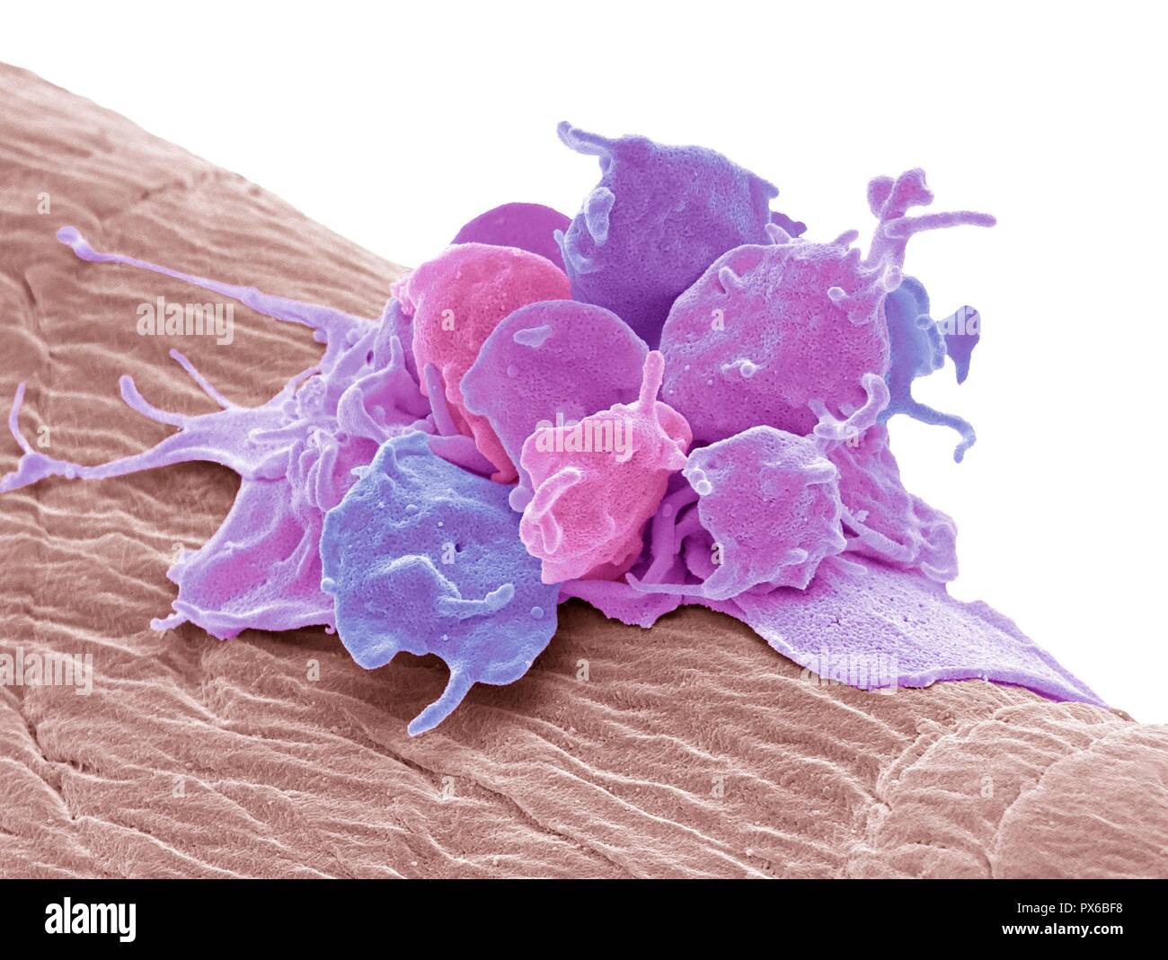 Activated platelets. Coloured scanning electron micrograph (SEM) of activated platelets attached to surgical gauze. Platelets are tiny blood cells tha Stock Photo