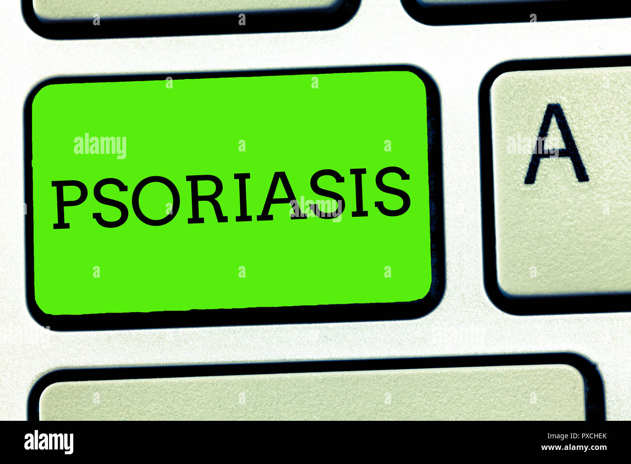 Writing note showing Psoriasis. Business photo showcasing Common skin