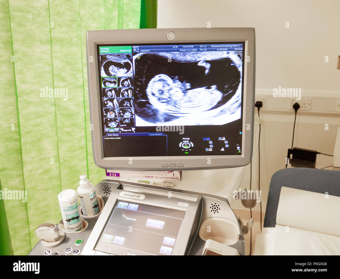 Hospital prenatal 12 week scan, UK Stock Photo