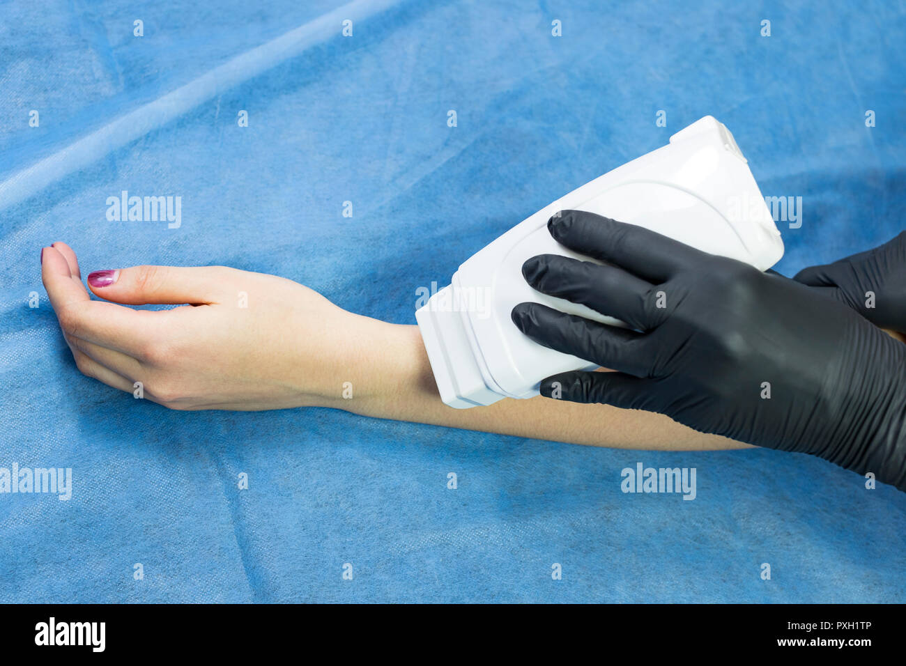 Process depilation female legs and hands in a beauty salon Stock Photo