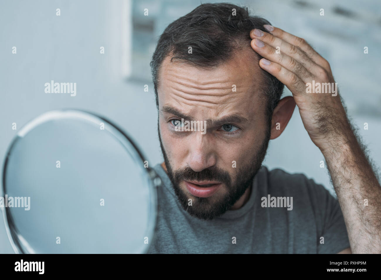 upset middle aged man with alopecia looking at mirror, hair loss concept Stock Photo