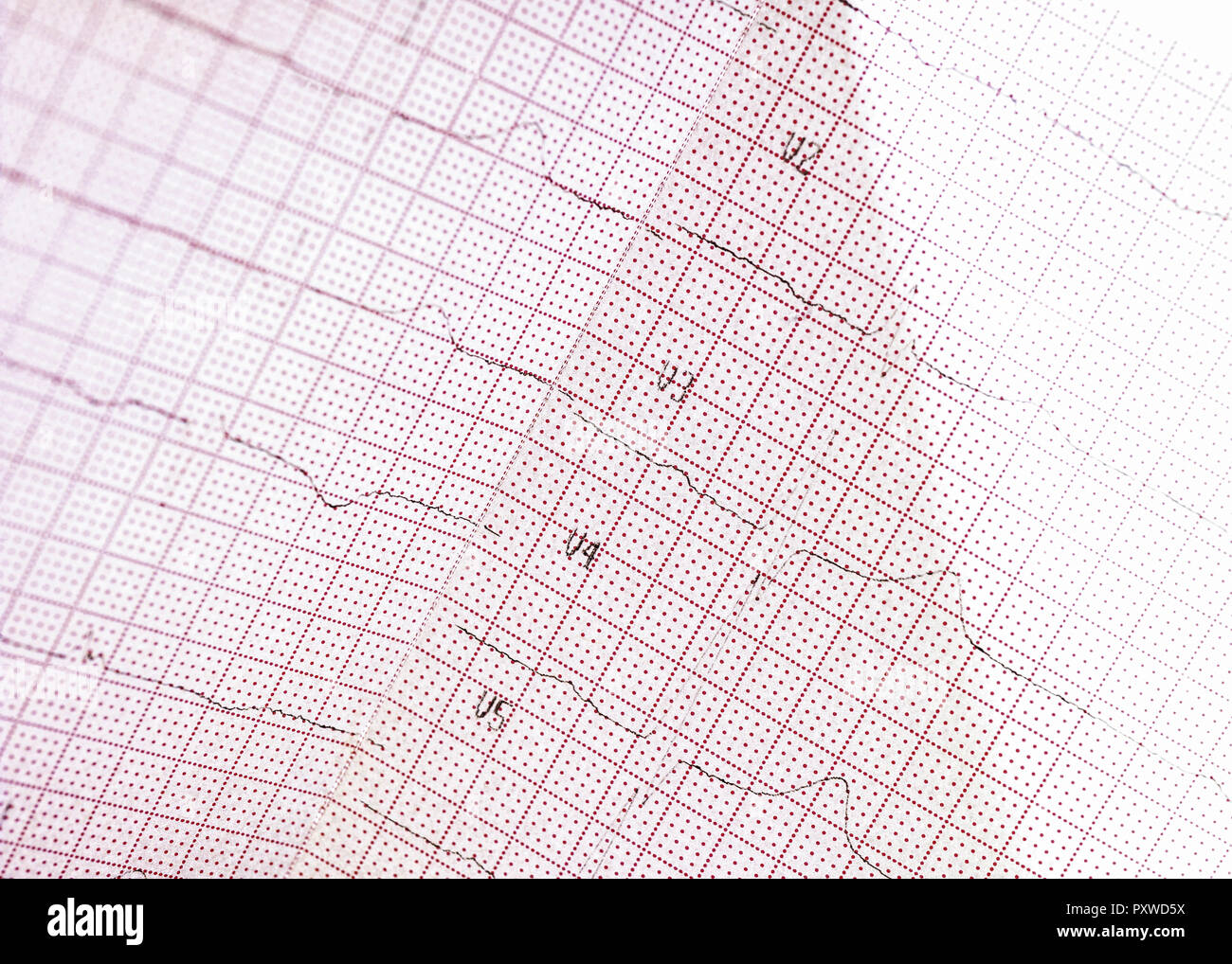 EKG-Ausdruck Stock Photo