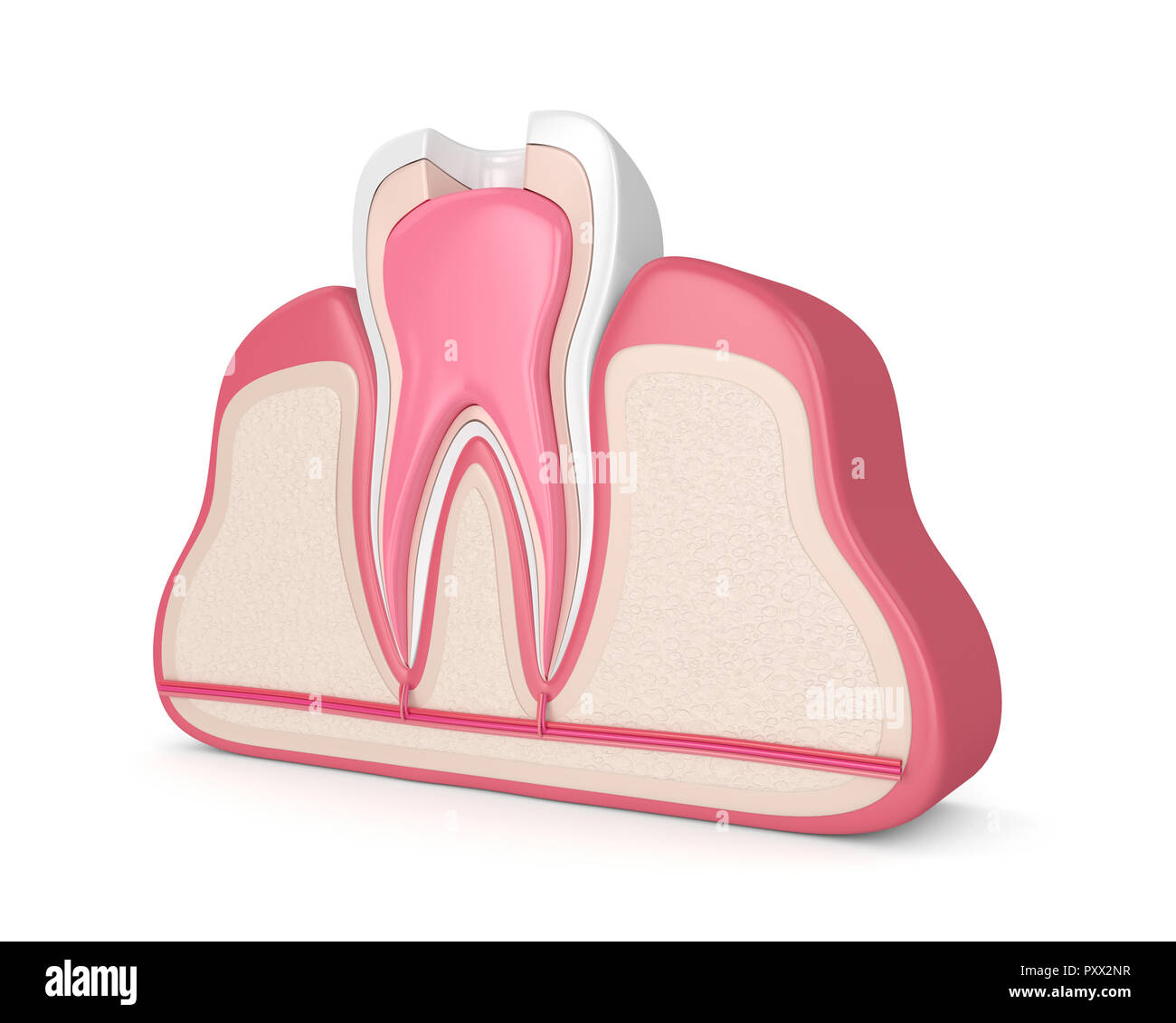 3d render of tooth in gums with root canal treatment procedure Stock Photo