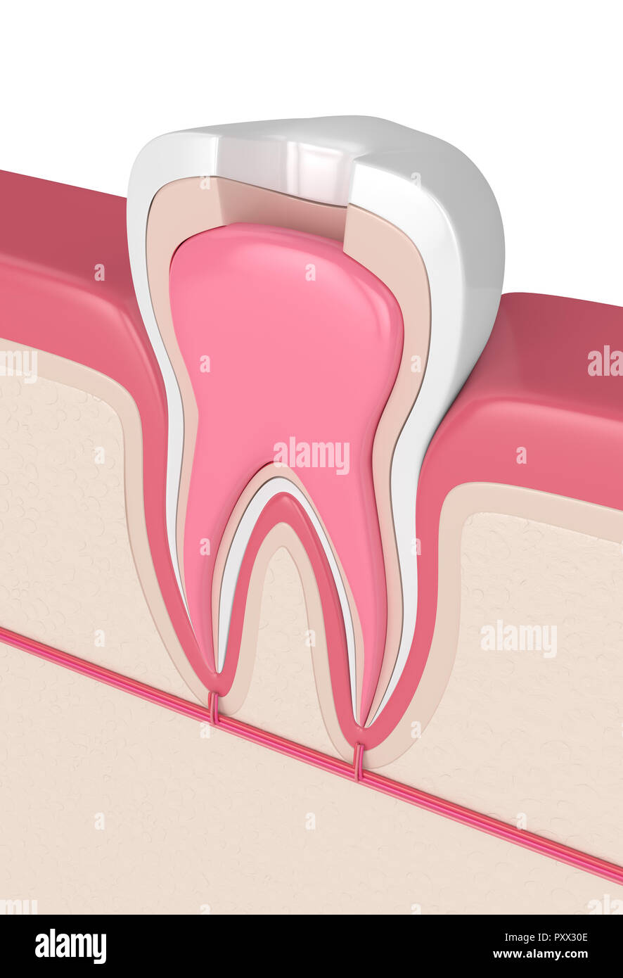 3d render of tooth in gums with root canal treatment procedure Stock Photo