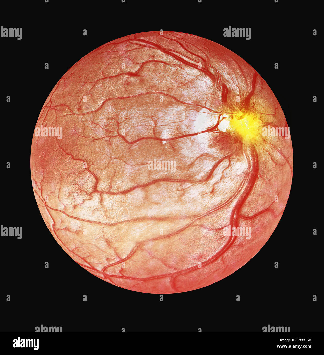 3d Illustration Of Optical Coherence Tomography OCT Stock Photo - Alamy