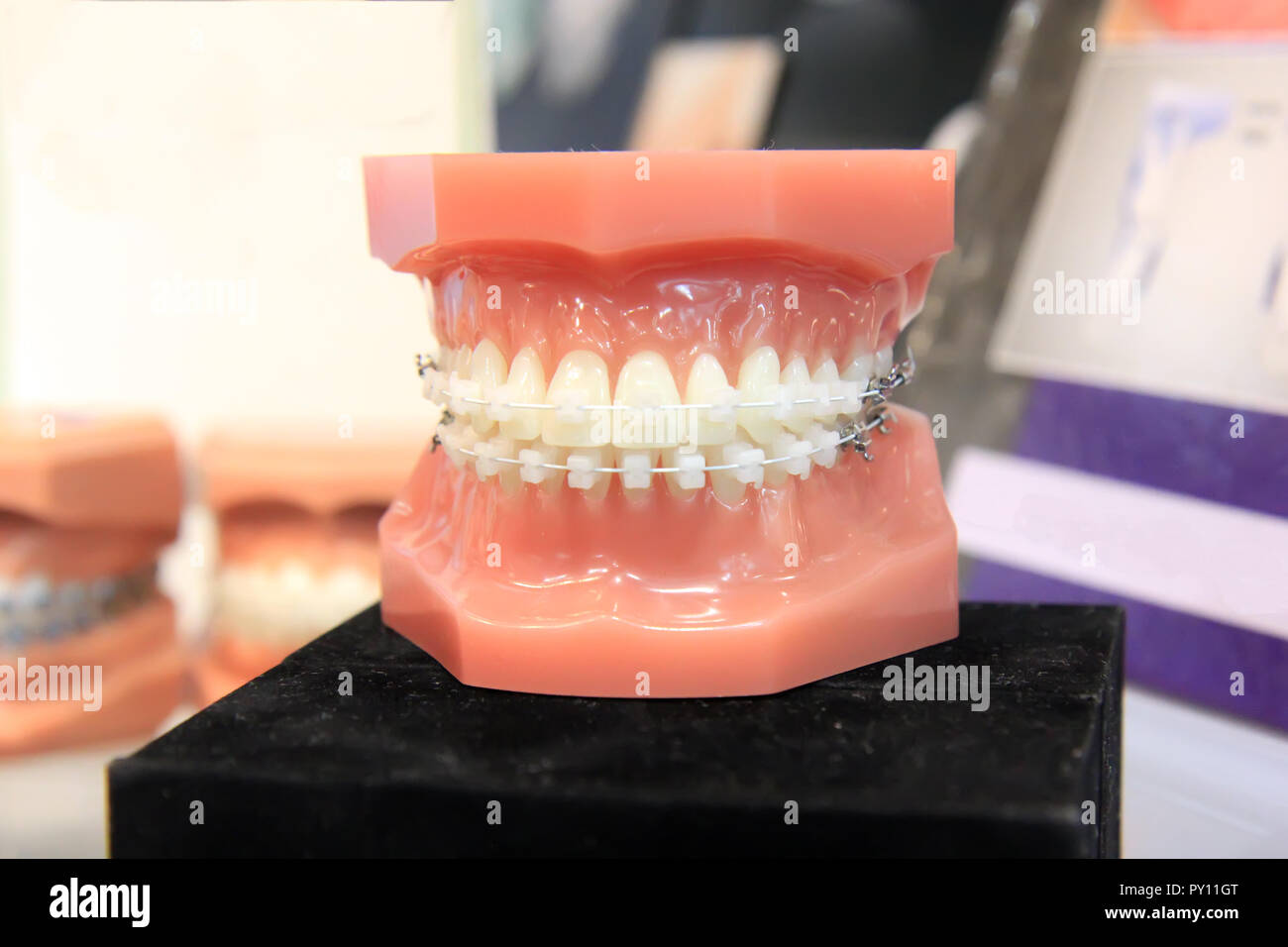 Dental prosthesis. Artificial human jaw with teeth Stock Photo Alamy