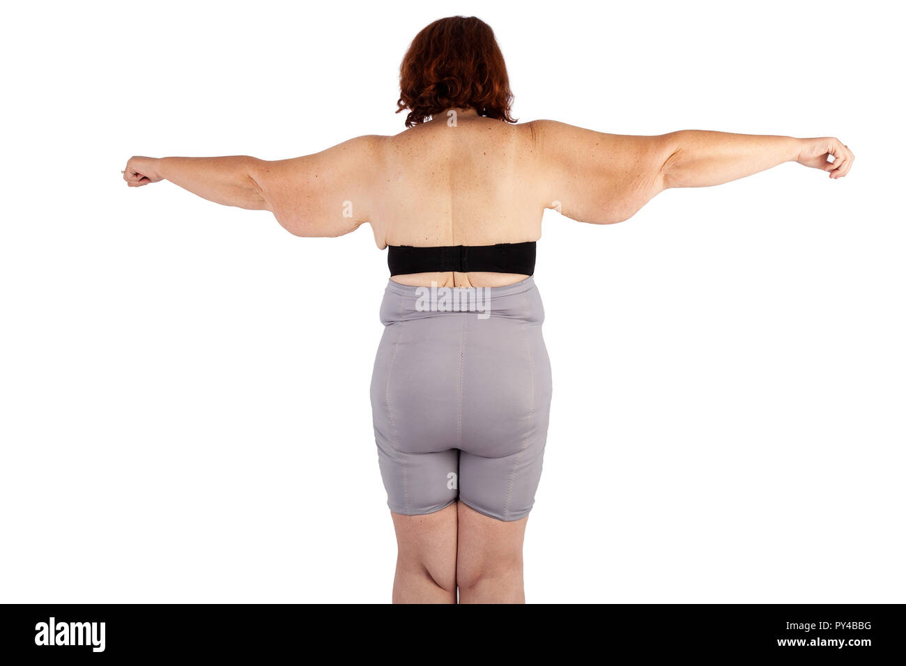 Woman Saggy Skin High Resolution Stock Photography and Images Alamy