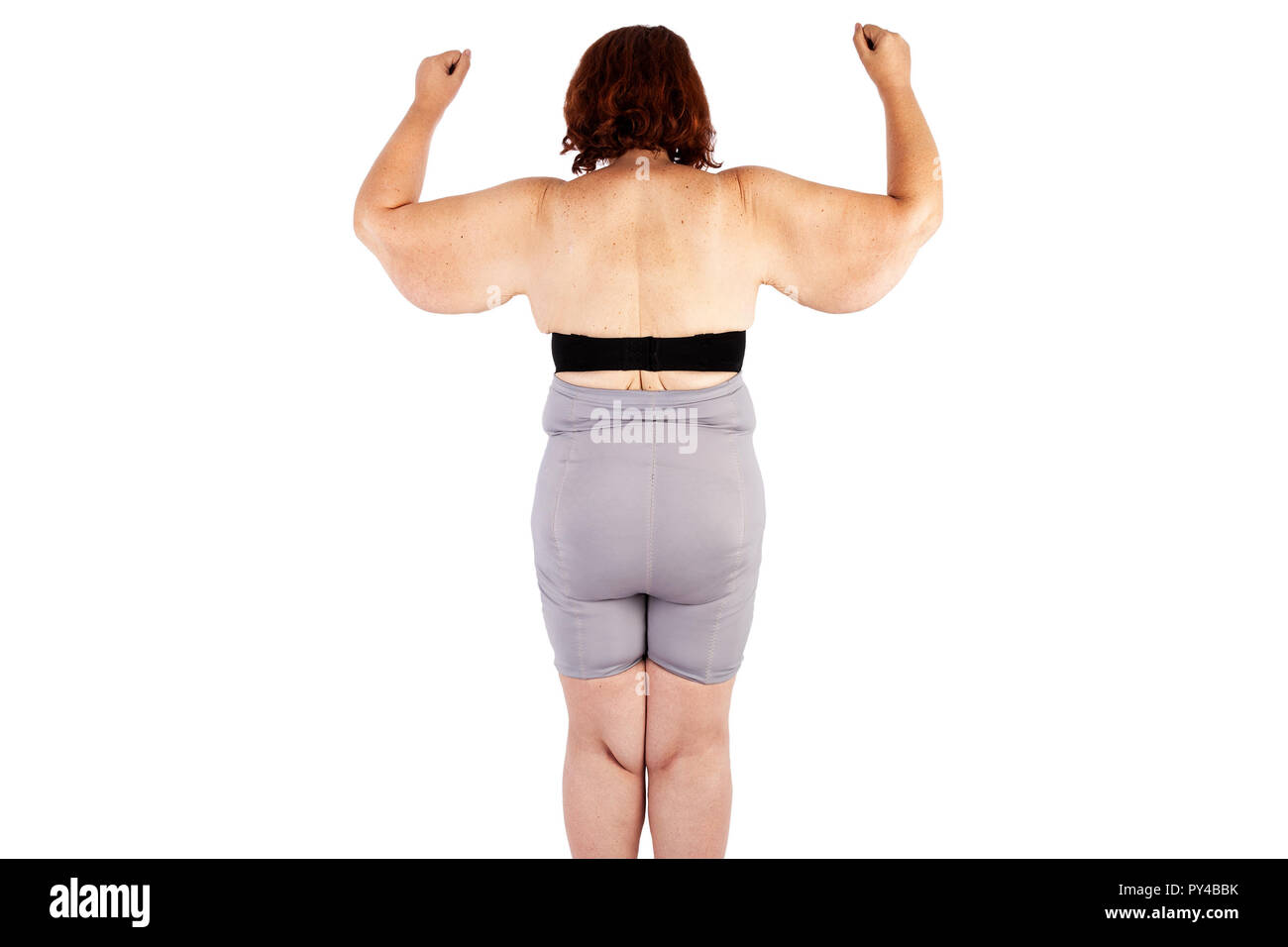Middle aged woman with saggy skin after extreme weight loss Stock Photo