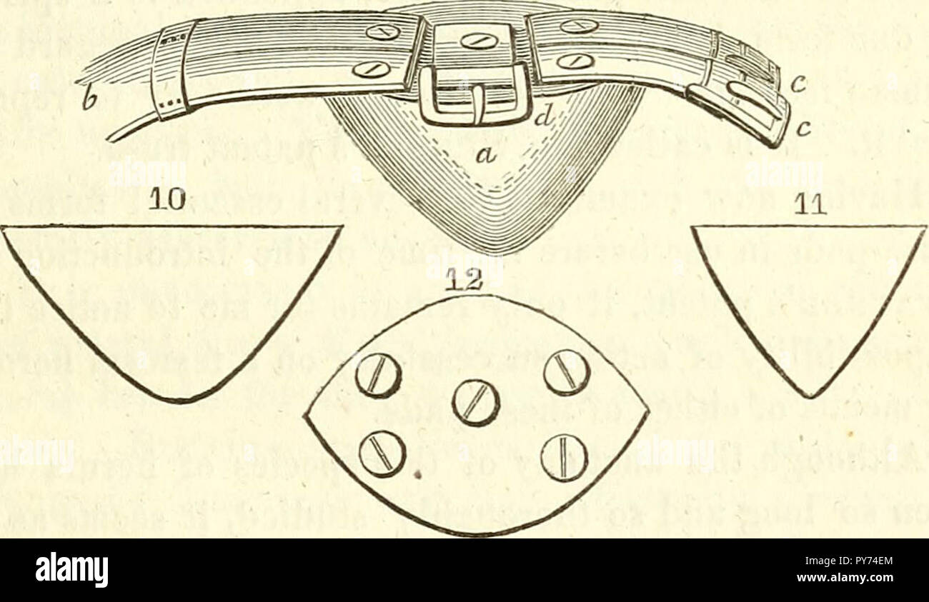 Treatise on the radical cure of hernia by instruments : embracing an analysis of the mechanical properties of the various trusses now in use, a description of the new instruments invented by the author, and general directions to patients for the safe employment of these instruments, with hints to surgeons in their application, etc. Stock Photo