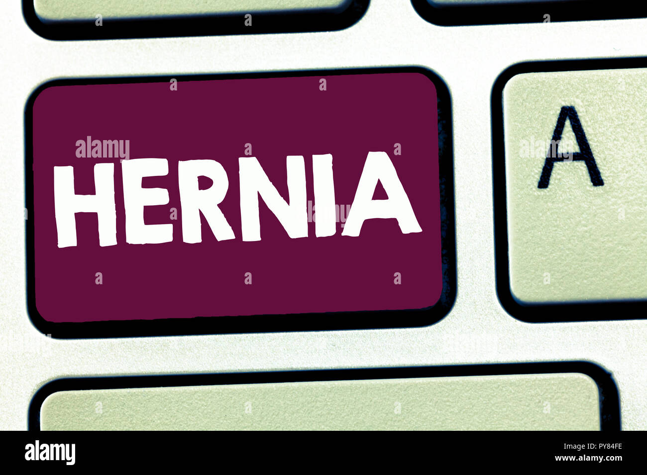 Text sign showing hernia conceptual photo abnormal exit of tissue or