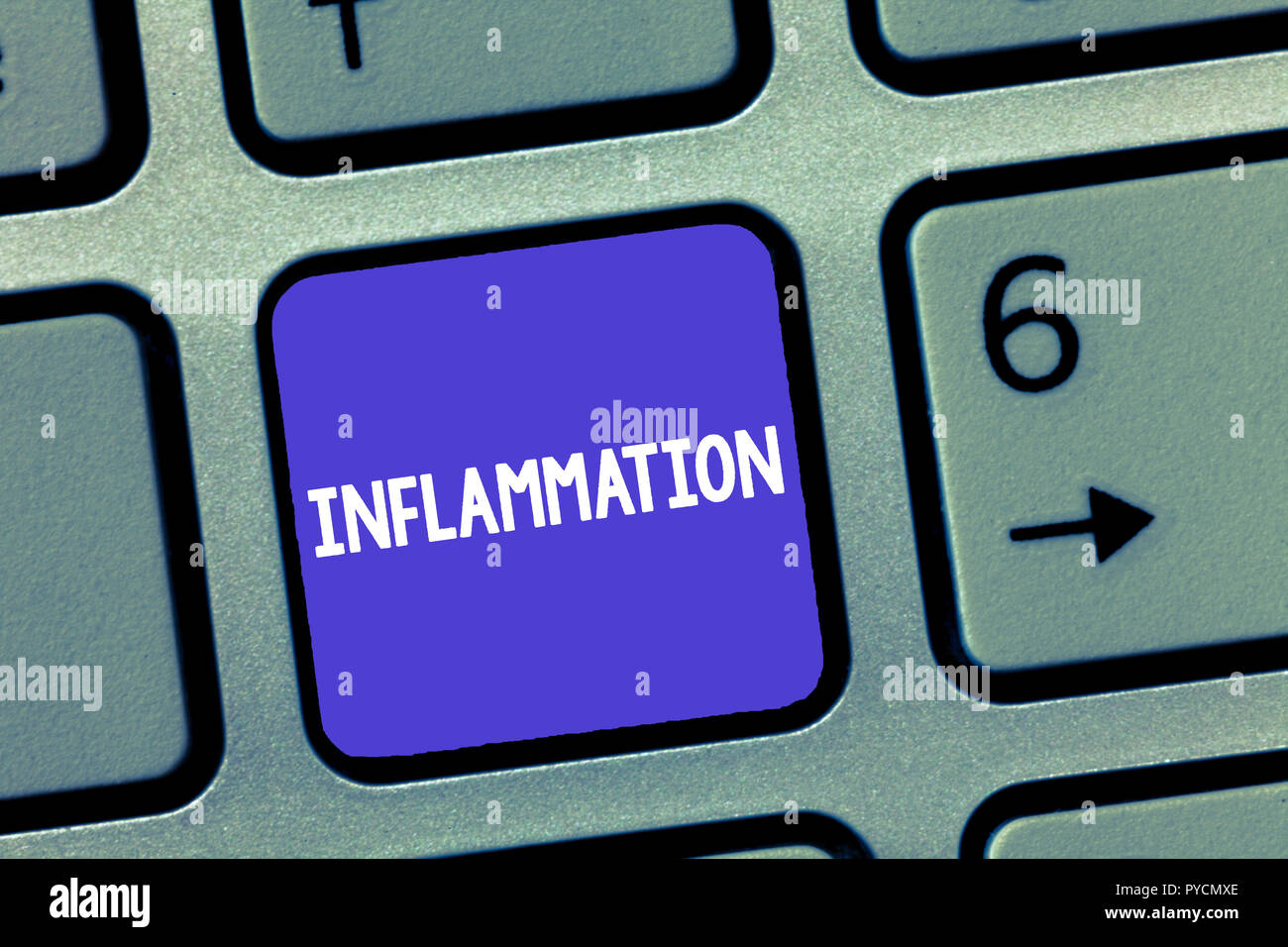 Word writing text Inflammation. Business concept for Swelling of a part