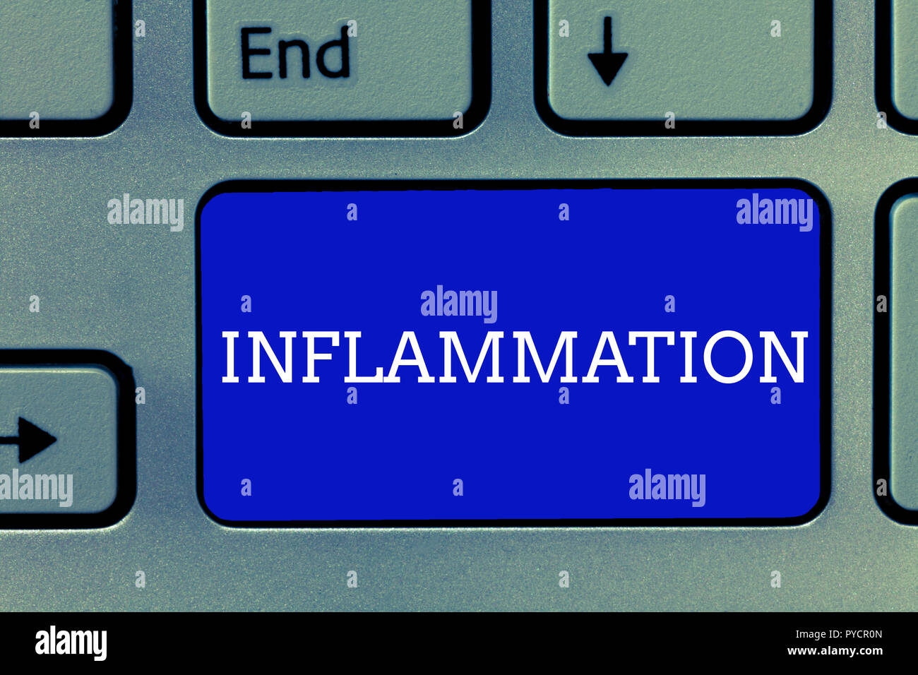 Handwriting text Inflammation. Concept meaning Swelling of a part of